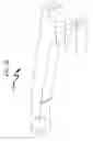 Fig. 81 - Ophthalmic laser treatment system and method