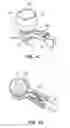 Fig. 09 - Patient interface for ophthalmologic diagnostic and interventional procedures