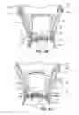 Fig. 11 - Patient interface for ophthalmologic diagnostic and interventional procedures
