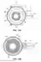 Fig. 31 - Patient interface for ophthalmologic diagnostic and interventional procedures