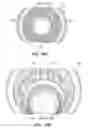 Fig. 32 - Patient interface for ophthalmologic diagnostic and interventional procedures