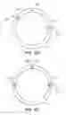 Fig. 35 - Patient interface for ophthalmologic diagnostic and interventional procedures
