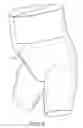 Fig. 06 - Absorbent article with selectively positioned waist containment member having an improved waist seal