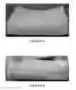 Fig. 03 - Two-stage microparticle-based therapeutic delivery system and method