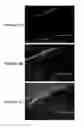 Fig. 05 - Two-stage microparticle-based therapeutic delivery system and method
