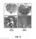 Fig. 12 - Methods of Use of Inhibitors of Phosphodiesterases and Modulators of Nitric Oxide, Reactive Oxygen Species, and Metalloproteinases in the Treatment of Peyronie's Disease, Arteriosclerosis and Other Fibrotic Diseases