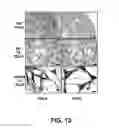Fig. 14 - Methods of Use of Inhibitors of Phosphodiesterases and Modulators of Nitric Oxide, Reactive Oxygen Species, and Metalloproteinases in the Treatment of Peyronie's Disease, Arteriosclerosis and Other Fibrotic Diseases
