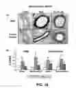 Fig. 17 - Methods of Use of Inhibitors of Phosphodiesterases and Modulators of Nitric Oxide, Reactive Oxygen Species, and Metalloproteinases in the Treatment of Peyronie's Disease, Arteriosclerosis and Other Fibrotic Diseases