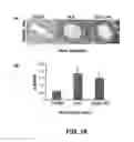 Fig. 19 - Methods of Use of Inhibitors of Phosphodiesterases and Modulators of Nitric Oxide, Reactive Oxygen Species, and Metalloproteinases in the Treatment of Peyronie's Disease, Arteriosclerosis and Other Fibrotic Diseases