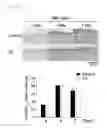 Fig. 28 - Epidithiodioxopiperazine compound or its derivatives, and the use thereof