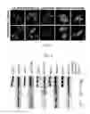 Fig. 03 - COMPOSITIONS AND METHODS TO TREAT AND/OR PREVENT VISION DISORDERS OF THE LENS OF THE EYE
