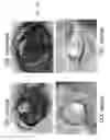 Fig. 07 - COMPOSITIONS AND METHODS TO TREAT AND/OR PREVENT VISION DISORDERS OF THE LENS OF THE EYE