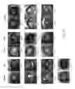 Fig. 08 - COMPOSITIONS AND METHODS TO TREAT AND/OR PREVENT VISION DISORDERS OF THE LENS OF THE EYE
