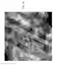 Fig. 09 - COMPOSITIONS AND METHODS TO TREAT AND/OR PREVENT VISION DISORDERS OF THE LENS OF THE EYE
