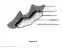 Fig. 03 - DEVICE AND METHOD TO TREAT OR PREVENT JOINT DEGENERATION