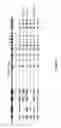 Fig. 18 - COMPOSITIONS AND METHODS FOR TREATING B-LYMPHOID MALIGNANCIES