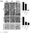 Fig. 07 - Cell therapy composition for preventing or treating immune disease comprising mesenchymal stem cells and immunoregulatory t-cells as active ingredient