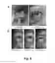 Fig. 06 - COMPOSITION OF DOXYCYCLINE IN LIPOSOMES FOR THE PREVENTION, IMPROVEMENT AND/OR TREATMENT OF OCULAR PATHOLOGIES