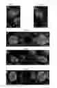 Fig. 10 - Regeneration of Inner Ear Cells