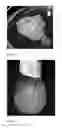 Fig. 06 - METHODS AND COMPOSITIONS TO PRODUCE VACCINES AGAINST SMALLPOX IN PLANTS