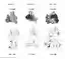 Fig. 55 - COMPOSITIONS AND METHODS RELATED TO NEUROLOGICAL DISORDERS