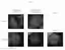 Fig. 21 - ANTI-B7-H4 ANTIBODIES AND IMMUNOCONJUGATES