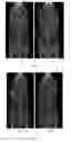 Fig. 04 - Molecular probes for multimodality imaging and tracking of stem cells
