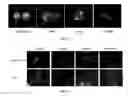 Fig. 06 - Molecular probes for multimodality imaging and tracking of stem cells