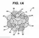 Fig. 02 - High strength suture with absorbable core and suture anchor combination