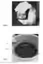Fig. 02 - Biologic composition and method of manufacture