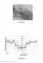 Fig. 08 - SYSTEMS AND METHODS FOR PROVIDING OXYGEN TO TRANSPLANTED CELLS