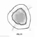 Fig. 20 - Method and apparatus for treating bone fractures, and/or for fortifying and/or augmenting bone, including the provision and use of composite implants, and novel composite structures which may be used for medical and non-medical applications
