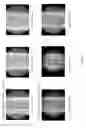 Fig. 07 - COATINGS CONTAINING MULTIPLE DRUGS