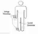 Fig. 01 - Estimation of the dry weight of a dialysis patient