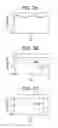 Fig. 03 - Estimation of the dry weight of a dialysis patient