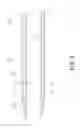 Fig. 03 - CATHETER