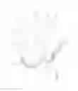 Fig. 10 - Neurovascular catheter extension segment
