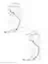 Fig. 13 - Neurovascular catheter extension segment