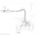 Fig. 03 - ANCHORING GUIDEWIRE