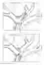 Fig. 04 - ANCHORING GUIDEWIRE