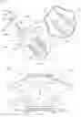 Fig. 03 - Systems and methods for anchoring medical devices