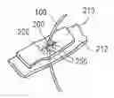 Fig. 01 - TISSUE-CAPTURED ANCHORS AND METHODS OF USE