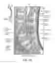 Fig. 04 - TISSUE-CAPTURED ANCHORS AND METHODS OF USE
