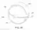 Fig. 16 - TISSUE-CAPTURED ANCHORS AND METHODS OF USE