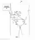 Fig. 02 - Incontinence therapy