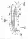 Fig. 02 - Implant infection control