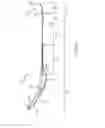 Fig. 03 - Implantable device having removable portion