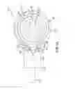 Fig. 04 - Implantable device having removable portion