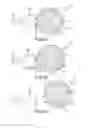 Fig. 09 - Implantable device having removable portion