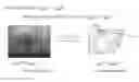 Fig. 01 - Uses for eye tracking in a visual prosthesis